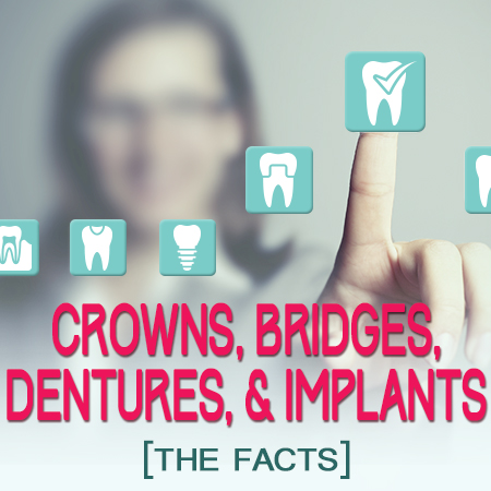 Abilene dentists, Dr. Webb & Dr. Awtrey, tell you about dental implants, crowns, bridges, and dentures at Abilene Family Dentistry.