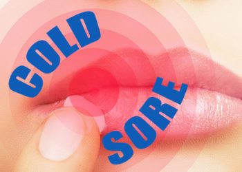 Abilene dentists, Dr. Webb & Dr. Awtrey at Abilene Family Dentistry, tell patients about cold sores – what they are, why they happen, and how to treat them.