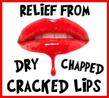 Abilene dentists, Dr. Awtrey & Dr. Webb at Abilene Family Dentistry, tells you how to relieve your dry, chapped, and cracked lips!