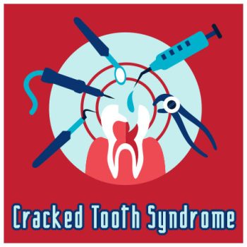 Abilene dentist, Dr. Webb & Dr. Awtrey at Abilene Family Dentistry, discusses causes, symptoms, and treatment of cracked tooth syndrome.