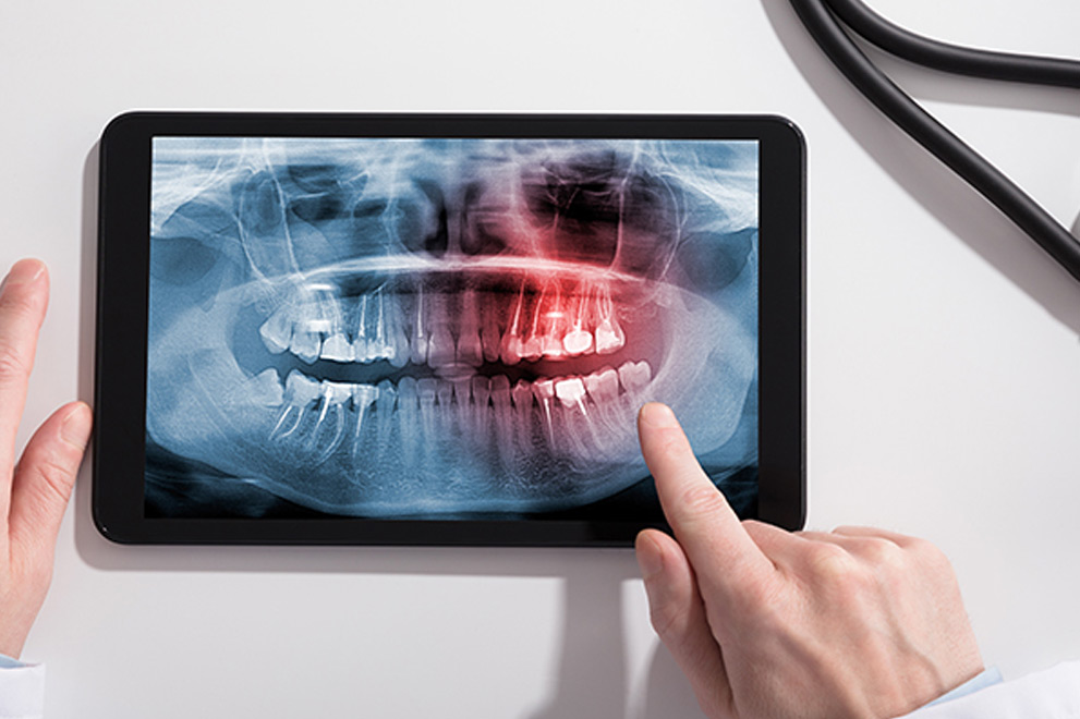 Digital X-Rays