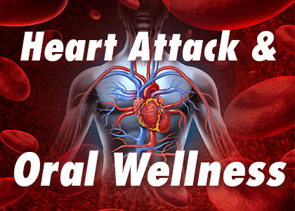 Abilene dentists, Dr. Webb & Dr.Awtrey at Abilene Family Dentistry explain the connection between poor oral hygiene and heart attacks.