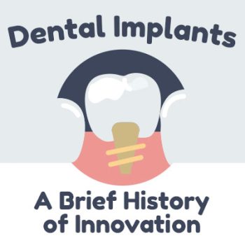Abilene dentists, Drs. Webb & Awtrey of Abilene Family Dentistry discusses dental implants and share some information about their history.