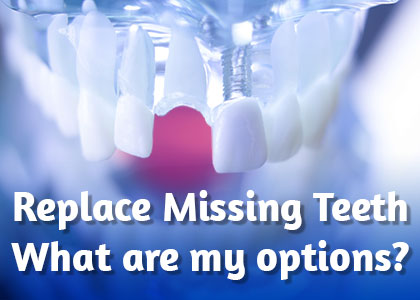 Abilene dentists, Dr. Webb & Dr. Awtrey of Abilene Family Dentistry discusses the tooth replacement options available to replace missing teeth and restore your smile.