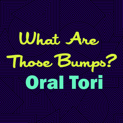 Abilene dentists, Dr. Webb & Dr. Awtrey at Abilene Family Dentistry explain oral tori—what they are, why they happen, and whether they are a cause for concern.