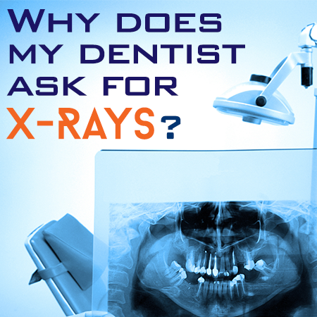 Abilene dentists, Dr. Webb & Dr. Awtrey at Abilene Family Dentistry, discuss the importance of dental x-rays for accurate diagnosis and treatment planning. 